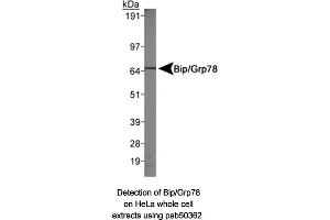 Image no. 1 for anti-Heat Shock 70kDa Protein 5 (Glucose-Regulated Protein, 78kDa) (HSPA5) (AA 250-300), (Internal Region) antibody (ABIN363671) (GRP78 antibody  (Internal Region))
