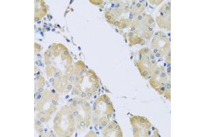 Immunohistochemistry of paraffin-embedded human stomach using ATP2C1 antibody (ABIN5975353) at dilution of 1/100 (40x lens).