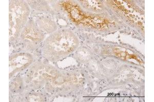 Image no. 1 for anti-S100 Calcium Binding Protein A5 (S100A5) (AA 1-91) antibody (ABIN598911) (S100A5 antibody  (AA 1-91))
