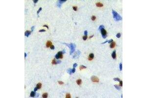 Immunohistochemical analysis of TEL2 staining in mouse brain formalin fixed paraffin embedded tissue section. (ETV7 antibody)