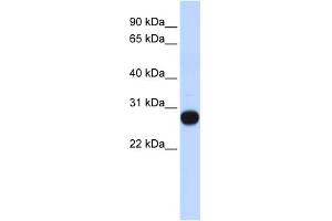 WB Suggested Anti-TCEAL4 Antibody Titration:  0. (TCEAL4 antibody  (Middle Region))