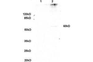 Formalin-fixed and paraffin embedded rat lung labeled with Anti-GPNMB/Osteoactivin Polyclonal Antibody, Unconjugated (ABIN749093) at 1:200 followed by conjugation to the secondary antibody and DAB staining. (Osteoactivin antibody  (AA 81-180))