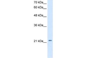 Western Blotting (WB) image for anti-Dickkopf Homolog 1 (DKK1) antibody (ABIN2463124) (DKK1 antibody)
