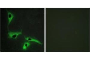 Immunofluorescence analysis of HeLa cells, using TSPAN8 Antibody. (Tspan-8 antibody  (AA 96-145))
