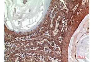 Immunohistochemistry (IHC) analysis of paraffin-embedded Human Skin, antibody was diluted at 1:100.