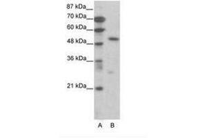 Image no. 1 for anti-Transcription Factor 7 (T-Cell Specific, HMG-Box) (TCF7) (AA 391-440) antibody (ABIN6736068) (TCF7 antibody  (AA 391-440))