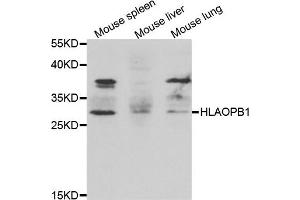 Western blot analysis of extracts of various cell lines, using HLA-DPB1 antibody. (HLA-DPB1 antibody)