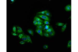 Immunofluorescence staining of HepG2 cells with ABIN7158613 at 1:66, counter-stained with DAPI.