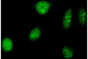 Immunofluorescence of purified MaxPab antibody to TAF12 on HeLa cell. (TAF12 antibody  (AA 1-161))