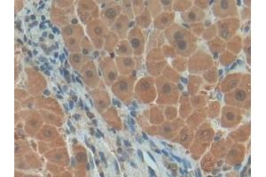 Detection of PDGF BB in Human Liver Tissue using Polyclonal Antibody to Platelet Derived Growth Factor BB (PDGF BB) (PDGF-BB Homodimer (AA 82-190) antibody)