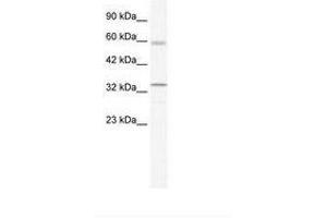 Image no. 1 for anti-Zinc Finger and BTB Domain Containing 7A (ZBTB7A) (AA 224-273) antibody (ABIN202788) (ZBTB7A antibody  (AA 224-273))