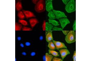 ABIN6258236 and ABIN6274733 staining  cells(UV treatment) by IF/ICC. (MRPL18 antibody  (Internal Region))