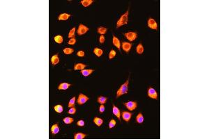 Immunofluorescence analysis of L929 cells using GBP2 Rabbit pAb  at dilution of 1:100 (40x lens). (GBP2 antibody  (AA 410-520))