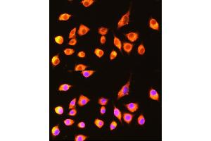 Immunofluorescence analysis of L929 cells using GBP2 Rabbit pAb  at dilution of 1:100 (40x lens). (GBP2 antibody  (AA 410-520))