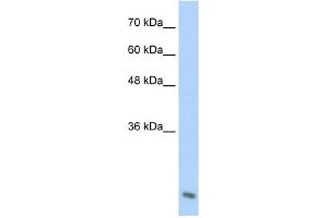 AES antibody used at 2. (AES antibody  (C-Term))