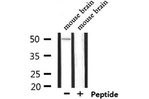 Western blot analysis of extracts from mouse brain, using KCNJ4 Antibody.