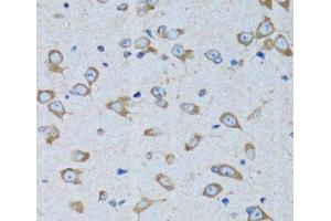 Immunohistochemistry of paraffin-embedded Rat brain using RARS Polyclonal Antibody at dilution of 1:100 (40x lens). (RARS antibody)