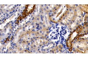 Immunohistochemistry (IHC) image for anti-Keratin 18 (KRT18) (AA 72-380) antibody (ABIN7433291)