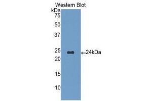 Western Blotting (WB) image for anti-Orosomucoid 1 (ORM1) (AA 19-201) antibody (ABIN1077768) (ORM1 antibody  (AA 19-201))