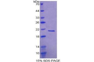 SDS-PAGE (SDS) image for Visinin-Like 1 (VSNL1) (AA 39-184) protein (His tag) (ABIN2127232)