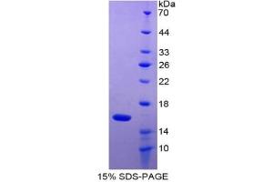 SDS-PAGE of Protein Standard from the Kit (Highly purified E. (GDF2 CLIA Kit)