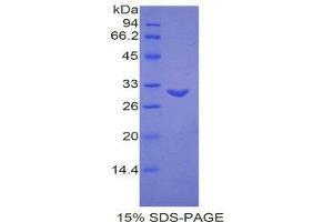 SDS-PAGE (SDS) image for Milk Fat Globule-EGF Factor 8 Protein (MFGE8) (AA 159-417) protein (His tag) (ABIN1877810)
