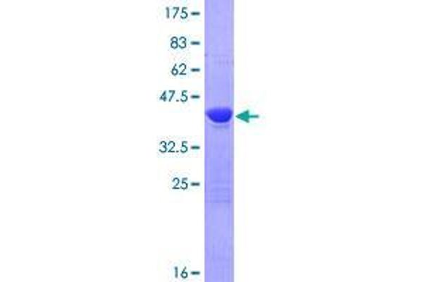 TSEN15 Protein (AA 1-171) (GST tag)
