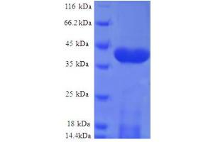 SDS-PAGE (SDS) image for NADH Dehydrogenase (Ubiquinone) Fe-S Protein 5, 15kDa (NADH-Coenzyme Q Reductase) (NDUFS5) (AA 2-106), (full length) protein (GST tag) (ABIN7479253)