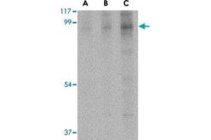 Western blot analysis of BRSK2 in human brain tissue lysate with BRSK2 polyclonal antibody  at (A) 0. (BRSK2 antibody  (C-Term))