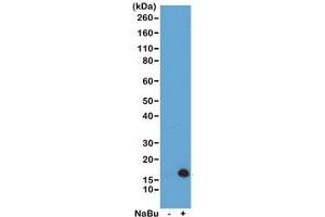 Western blot of acid extracts from HeLa cells untreated (-) or treated (+) with sodium butyrate using recombinant H3K4ac antibody at 0. (Recombinant Histone 3 antibody  (acLys4))