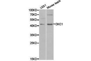 Western Blotting (WB) image for anti-Dyskeratosis Congenita 1, Dyskerin (DKC1) antibody (ABIN1872276) (DKC1 antibody)