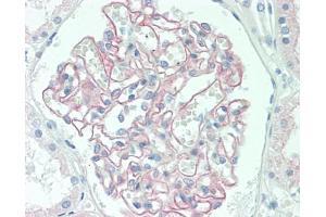 Immunohistochemistry (Paraffin-embedded Sections) (IHC (p)) image for anti-PDZ and LIM Domain 2 (PDLIM2) antibody (ABIN1500130)