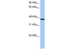 WB Suggested Anti-CSNK2A2 Antibody Titration: 0. (CSNK2A2 antibody  (C-Term))