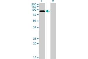 Western Blot analysis of PDE8A expression in transfected 293T cell line by PDE8A monoclonal antibody (M02), clone 1H6.