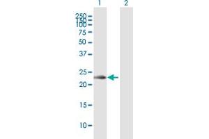 Western Blot analysis of KLRC2 expression in transfected 293T cell line by KLRC2 MaxPab polyclonal antibody. (KLRC2 antibody  (AA 1-231))