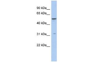 WB Suggested Anti-TRIM14 Antibody Titration:  0. (TRIM14 antibody  (Middle Region))