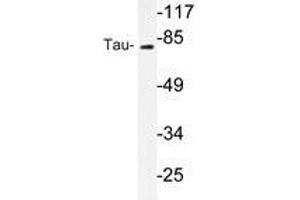Western blot analyzes of Tau antibody in extracts from mouse brain cells. (MAPT antibody)