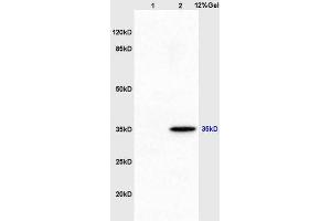 Lane 1: mouse embryo lysates Lane 2: mouse brain lysates probed with Anti AIMP2 Polyclonal Antibody, Unconjugated (ABIN741300) at 1:200 in 4 °C. (AIMP2 antibody  (AA 201-300))