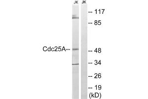 Western blot analysis of extracts from Jurkat cells, using CDC25A (epitope around residue 178) antibody. (CDC25A antibody  (Ser178))