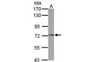 Image no. 1 for anti-ATP-Binding Cassette, Sub-Family D (Ald), Member 4 (ABCD4) (AA 38-296) antibody (ABIN1496386) (ABCD4 antibody  (AA 38-296))