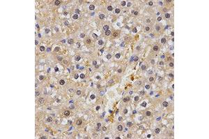Immunohistochemistry of paraffin-embedded rat liver tissue using HSF2 antibody at dilution of 1:200 (x400 lens) (HSF2 antibody)