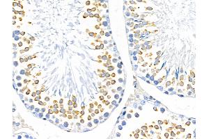 ABIN6263429 and ABIN6266804 at 1/100 staining Rat testis tissue by IHC-P.