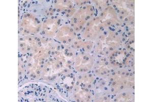 IHC-P analysis of kidney tissue, with DAB staining. (IL12A antibody  (AA 23-219))
