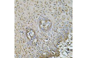 Immunohistochemistry of paraffin-embedded human esophagus using CPOX antibody (ABIN5971997) at dilution of 1/100 (40x lens).