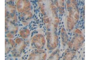 Detection of MUC5AC in Human Stomach Tissue using Polyclonal Antibody to Mucin 5 Subtype AC (MUC5AC) (MUC5AC antibody)