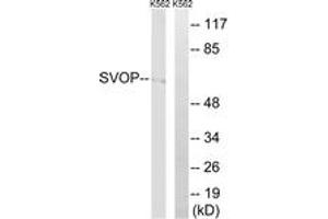 Western blot analysis of extracts from K562 cells, using SVOP Antibody. (SVOP antibody  (AA 271-320))