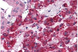 Human Adrenal: Formalin-Fixed, Paraffin-Embedded (FFPE) (LYRM2 antibody  (C-Term))