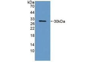 Detection of Recombinant GPA33, Rat using Polyclonal Antibody to Glycoprotein A33 (GPA33) (GPA33 antibody  (AA 22-235))