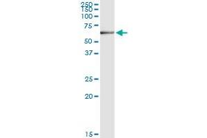Immunoprecipitation of DHCR24 transfected lysate using anti-DHCR24 MaxPab rabbit polyclonal antibody and Protein A Magnetic Bead , and immunoblotted with DHCR24 purified MaxPab mouse polyclonal antibody (B01P) . (Seladin 1 antibody  (AA 1-516))