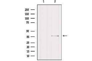 Western blot analysis of extracts from Rat heart, using SGCG Antibody. (SGCG antibody  (C-Term))